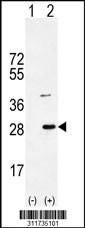 Western blot analysis of his-tag RHEB (arrow) using his tag antibody. 293 cell lysates (2 ug/lane) either nontransfected (Lane 1) or transiently transfected with the RHEB gene