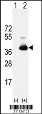 Western blot analysis of his-tag NEFL (arrow) using his tag antibody. 293 cell lysates (2 ug/lane) either nontransfected (Lane 1) or transiently transfected with the NEFL gene
