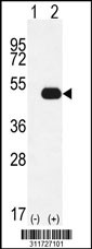 Western blot analysis of his-tag RRM2 (arrow) using his tag antibody. 293 cell lysates (2 ug/lane) either nontransfected (Lane 1) or transiently transfected with the RRM2 gene