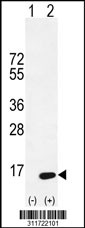 Western blot analysis of his-tag MARK4 (arrow) using his tag antibody. 293 cell lysates (2 ug/lane) either nontransfected (Lane 1) or transiently transfected with the MARK4 gene