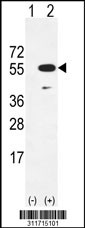 Western blot analysis of his-tag FMR1 (arrow) using his tag antibody. 293 cell lysates (2 ug/lane) either nontransfected (Lane 1) or transiently transfected with the FMR1 gene
