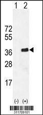 Western blot analysis of his-tag CBR1 (arrow) using his tag antibody. 293 cell lysates (2 ug/lane) either nontransfected (Lane 1) or transiently transfected with the CBR1 gene