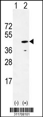Western blot analysis of his-tag CA4 (arrow) using his tag antibody. 293 cell lysates (2 ug/lane) either nontransfected (Lane 1) or transiently transfected with the CA4 gene