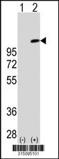 Western blot analysis of his-tag MAPK6 (arrow) using his tag antibody. 293T cell lysates (2 ug/lane) either nontransfected (Lane 1) or transiently transfected with the MAPK6 gene‘