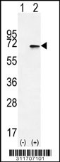 Western blot analysis of his-tag BMPR1A (arrow) using his tag antibody. 293 cell lysates (2 ug/lane) either nontransfected (Lane 1) or transiently transfected with the BMPR1A gene