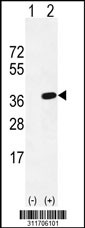 Western blot analysis of his-tag ATG5 (arrow) using his tag antibody. 293 cell lysates (2 ug/lane) either nontransfected (Lane 1) or transiently transfected with the ATG5 gene