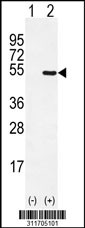 Western blot analysis of his-tag TFAP2A (arrow) using his tag antibody. 293 cell lysates (2 ug/lane) either nontransfected (Lane 1) or transiently transfected with the TFAP2A gene