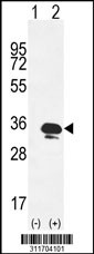 Western blot analysis of his-tag SNAP29 (arrow) using his tag antibody. 293 cell lysates (2 ug/lane) either nontransfected (Lane 1) or transiently transfected with the SNAP29 gene