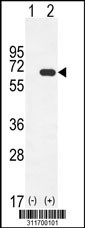Western blot analysis of his-tag PAPSS1 (arrow) using his tag antibody. 293 cell lysates (2 ug/lane) either nontransfected (Lane 1) or transiently transfected with the PAPSS1 gene