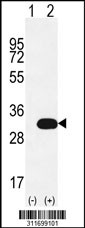 Western blot analysis of his-tag NNMT (arrow) using his tag antibody. 293 cell lysates (2 ug/lane) either nontransfected (Lane 1) or transiently transfected with the NNMT gene
