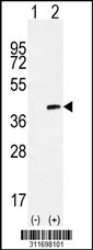 Western blot analysis of his-tag NEUROG1 (arrow) using his tag antibody. 293 cell lysates (2 ug/lane) either nontransfected (Lane 1) or transiently transfected with the NEUROG1 gene