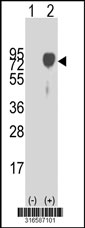 Western blot analysis of his-tag SELE (arrow) using his tag antibody. 293T cell lysates (2 ug/lane) either nontransfected (Lane 1) or transiently transfected with the SELE gene‘