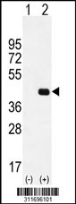 Western blot analysis of his-tag MPG (arrow) using his tag antibody. 293 cell lysates (2 ug/lane) either nontransfected (Lane 1) or transiently transfected with the MPG gene