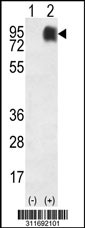 Western blot analysis of his-tag LAMP1 (arrow) using his tag antibody. 293 cell lysates (2 ug/lane) either nontransfected (Lane 1) or transiently transfected with the LAMP1 gene