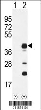 Western blot analysis of his-tag GJA4 (arrow) using his tag antibody. 293 cell lysates (2 ug/lane) either nontransfected (Lane 1) or transiently transfected with the GJA4 gene