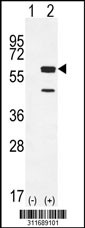 Western blot analysis of his-tag FSCN1 (arrow) using his tag antibody. 293 cell lysates (2 ug/lane) either nontransfected (Lane 1) or transiently transfected with the FSCN1 gene