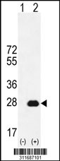 Western blot analysis of his-tag FKBP11 (arrow) using his tag antibody. 293 cell lysates (2 ug/lane) either nontransfected (Lane 1) or transiently transfected with the FKBP11 gene