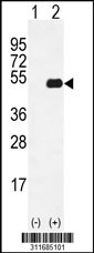 Western blot analysis of his-tag DPF2 (arrow) using his tag antibody. 293 cell lysates (2 ug/lane) either nontransfected (Lane 1) or transiently transfected with the DPF2 gene