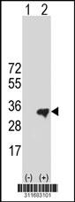 Western blot analysis of his-tag COL2A1 (arrow) using his tag antibody. 293 cell lysates (2 ug/lane) either nontransfected (Lane 2) or transiently transfected with theCOL2A1 gene