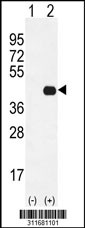 Western blot analysis of his-tag CALHM1 (arrow) using his tag antibody. 293 cell lysates (2 ug/lane) either nontransfected (Lane 1) or transiently transfected with the CALHM1 gene