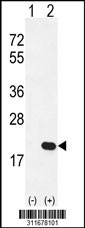 Western blot analysis of his-tag ALKBH3 (arrow) using his tag antibody. 293 cell lysates (2 ug/lane) either nontransfected (Lane 1) or transiently transfected with the ALKBH3 gene