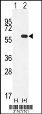 Western blot analysis of his-tag AGXT2L1 (arrow) using his tag antibody. 293 cell lysates (2 ug/lane) either nontransfected (Lane 1) or transiently transfected with the AGXT2L1 gene