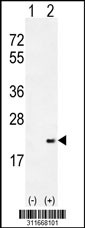 Western blot analysis of his-tag HSPA4 (arrow) using his tag antibody. 293 cell lysates (2 ug/lane) either nontransfected (Lane 1) or transiently transfected with the HSPA4 gene