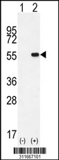 Western blot analysis of his-tag HARS2 (arrow) using his tag antibody. 293 cell lysates (2 ug/lane) either nontransfected (Lane 1) or transiently transfected with the HARS2 gene