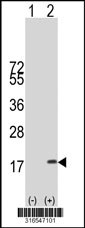 Western blot analysis of his-tag DAPL1 (arrow) using his tag antibody. 293T cell lysates (2 ug/lane) either nontransfected (Lane 1) or transiently transfected with the DAPL1 gene‘