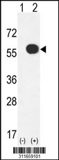 Western blot analysis of his-tag ALDH2 (arrow) using his tag antibody. 293 cell lysates (2 ug/lane) either nontransfected (Lane 1) or transiently transfected with the ALDH2 gene