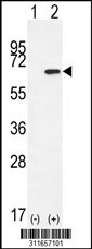 Western blot analysis of his-tag PPAT (arrow) using his tag antibody. 293 cell lysates (2 ug/lane) either nontransfected (Lane 1) or transiently transfected with the PPAT gene