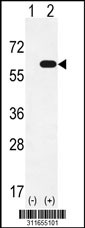Western blot analysis of his-tag KPNA4 (arrow) using his tag antibody. 293 cell lysates (2 ug/lane) either nontransfected (Lane 1) or transiently transfected with the KPNA4 gene