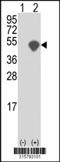 Western blot analysis of his-tag PEG10 (arrow) using his tag antibody. 293T cell lysates (2 ug/lane) either nontransfected (Lane 1) or transiently transfected with the PEG10 gene‘