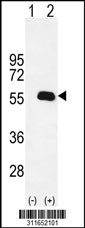 Western blot analysis of his-tag ALDH6A1 (arrow) using his tag antibody. 293 cell lysates (2 ug/lane) either nontransfected (Lane 1) or transiently transfected with the ALDH6A1 gene