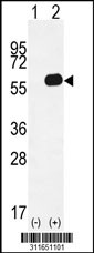 Western blot analysis of his-tag AAK1 (arrow) using his tag antibody. 293 cell lysates (2 ug/lane) either nontransfected (Lane 1) or transiently transfected with the AAK1 gene