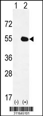 Western blot analysis of his-tag PSAP (arrow) using his tag antibody. 293 cell lysates (2 ug/lane) either nontransfected (Lane 1) or transiently transfected with the PSAP gene