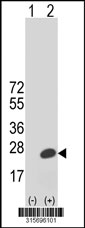 Western blot analysis of his-tag BUD31 (arrow) using his tag antibody. 293T cell lysates (2 ug/lane) either nontransfected (Lane 1) or transiently transfected with the BUD31 gene‘