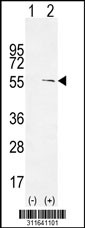 Western blot analysis of his-tag CFLAR (arrow) using his tag antibody. 293 cell lysates (2 ug/lane) either nontransfected (Lane 1) or transiently transfected with the CFLAR gene