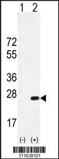 Western blot analysis of his-tag ARL1 (arrow) using his tag antibody. 293 cell lysates (2 ug/lane) either nontransfected (Lane 1) or transiently transfected with the ARL1 gene
