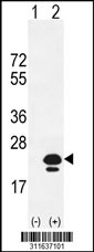 Western blot analysis of his-tag ARF6 (arrow) using his tag antibody. 293 cell lysates (2 ug/lane) either nontransfected (Lane 1) or transiently transfected with the ARF6 gene