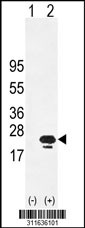 Western blot analysis of his-tag ARF3 (arrow) using his tag antibody. 293 cell lysates (2 ug/lane) either nontransfected (Lane 1) or transiently transfected with the ARF3 gene