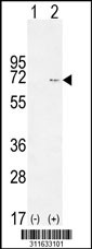 Western blot analysis of his-tag RAF1 (arrow) using his tag antibody. 293 cell lysates (2 ug/lane) either nontransfected (Lane 1) or transiently transfected with the RAF1 gene