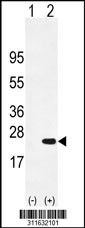 Western blot analysis of his-tag POLE3 (arrow) using his tag antibody. 293 cell lysates (2 ug/lane) either nontransfected (Lane 1) or transiently transfected with the POLE3 gene