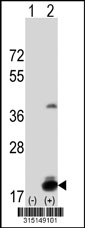 Western blot analysis of his-tag C2orf40 (arrow) using his tag antibody. 293T cell lysates (2 ug/lane) either nontransfected (Lane 1) or transiently transfected with the C2orf40 gene‘