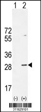 Western blot analysis of his-tag MRE11A (arrow) using his tag antibody. 293 cell lysates (2 ug/lane) either nontransfected (Lane 1) or transiently transfected with the MRE11A gene