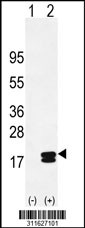 Western blot analysis of his-tag HYOU1 (arrow) using his tag antibody. 293 cell lysates (2 ug/lane) either nontransfected (Lane 1) or transiently transfected with the HYOU1 gene
