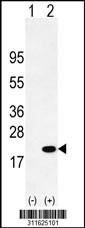 Western blot analysis of his-tag HDAC6 (arrow) using his tag antibody. 293 cell lysates (2 ug/lane) either nontransfected (Lane 1) or transiently transfected with the HDAC6 gene
