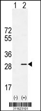 Western blot analysis of his-tag BAK1 (arrow) using his tag antibody. 293 cell lysates (2 ug/lane) either nontransfected (Lane 1) or transiently transfected with the BAK1 gene