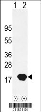 Western blot analysis of his-tag ALOX5AP (arrow) using his tag antibody. 293 cell lysates (2 ug/lane) either nontransfected (Lane 1) or transiently transfected with the ALOX5AP gene