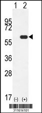 Western blot analysis of his-tag NARS2 (arrow) using his tag antibody. 293 cell lysates (2 ug/lane) either nontransfected (Lane 1) or transiently transfected with the NARS2 gene